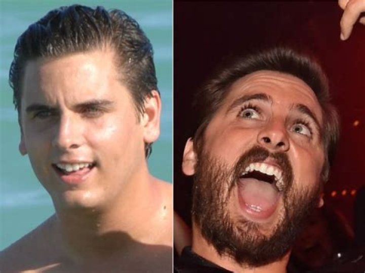 Scott Disick Vs. Younes Bendjima: Which Of Kourtney’s Loves Has The Hottest Shirtless Pics?