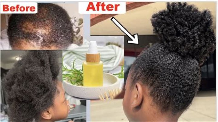 This $8 Product Completely Transforms Your Hair In Just 8 Seconds