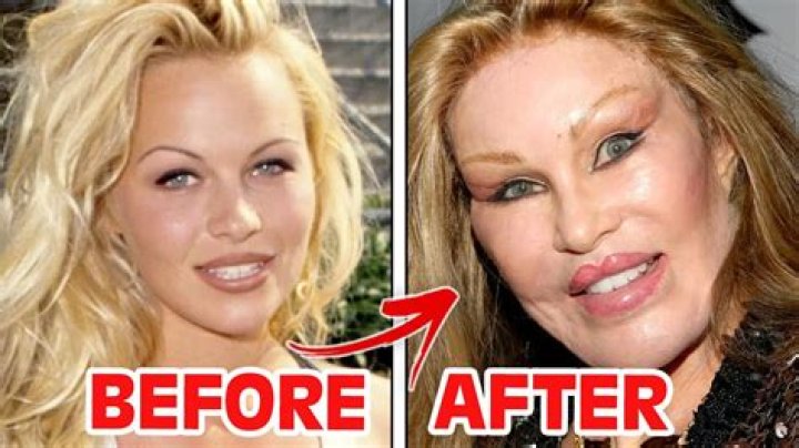 Weight Loss By Plastic Surgery? — Is She Faking It? – Hollywood Life